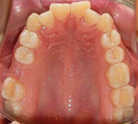 Fig. 3 Vista oclusal