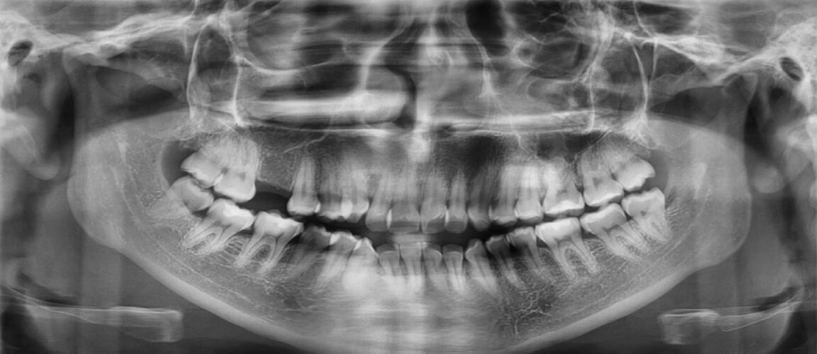 Fig. 7 Radiografia Panorámica