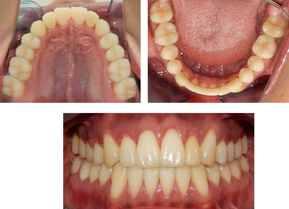 Fig.10 frente final