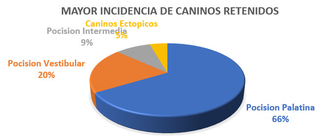 Figura 1: Grafica de Porcentajes de Clasificación según su posición de caninos retenidos