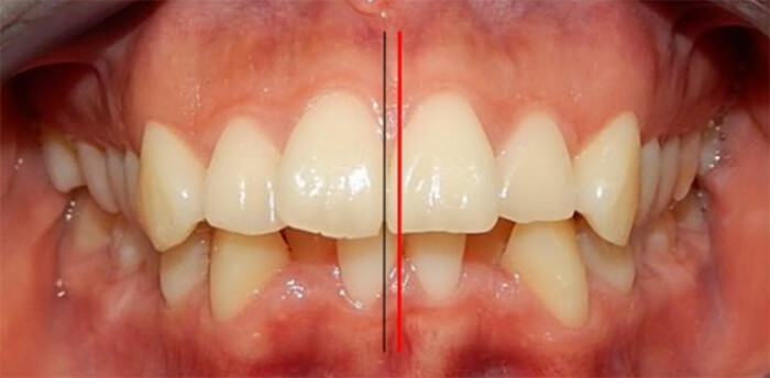 Fig. 4 Oclusal de frente