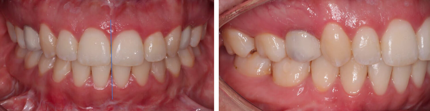 Fig. 7 frente intraoral