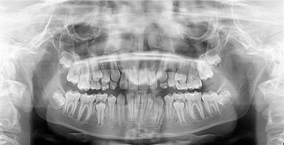 Figura 8. Panorámica final