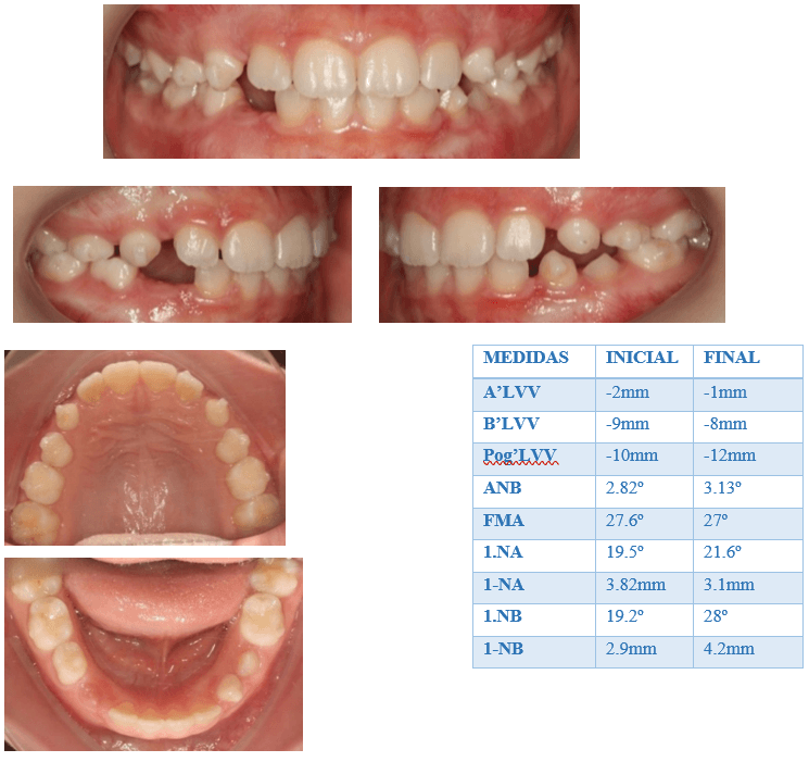 Figura 7. Radiografía lateral, LVV y medidas cefalométricas iniciales y finales 