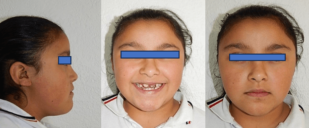 Fig. 1 inicio, frente