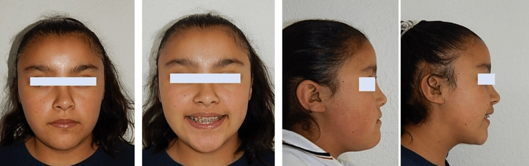 Fig. 5 Frente, sonrisa, perfil