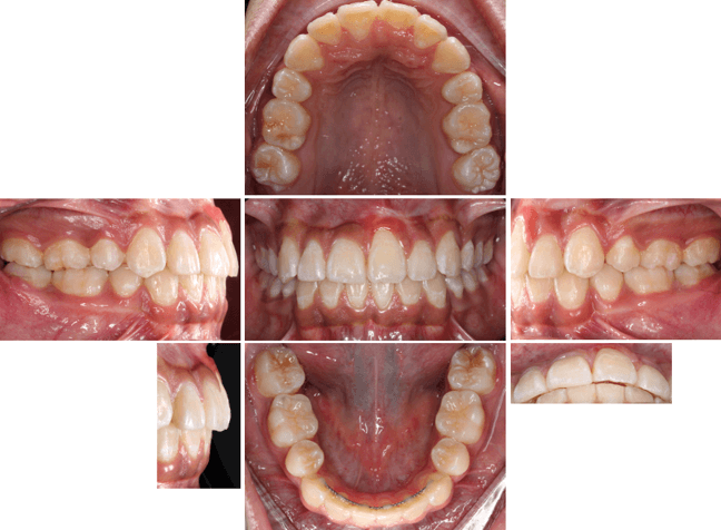 Imagen 10. Fotografías intraorales finales
