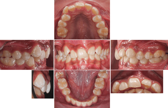 Imagen 5. Fotografía de inicio