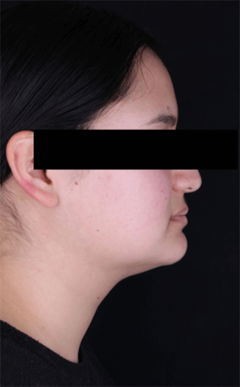 Figura 1. Fotografía de perfil.