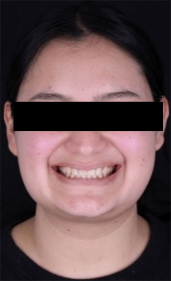 Figura 3. Fotografía de sonrisa.