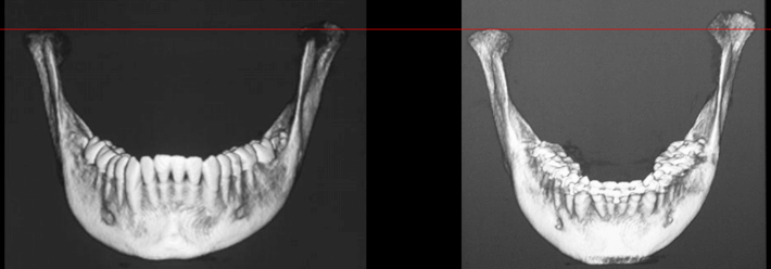 Tomografía Cone Beam Inicial