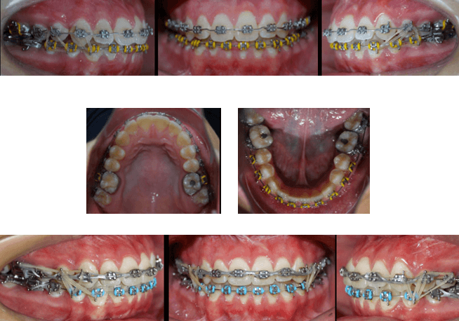 Fase de Finalización