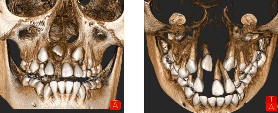 Fig 7. Renderizado 3D frontal - Fig 8. Renderizado 3D vista superior