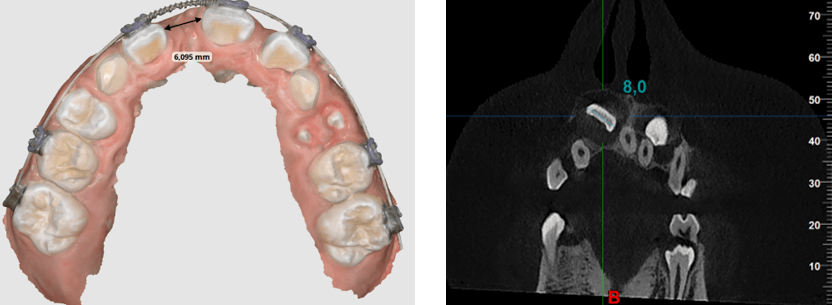 Fig 9 y 10. Espacio disponible y espacio requerido