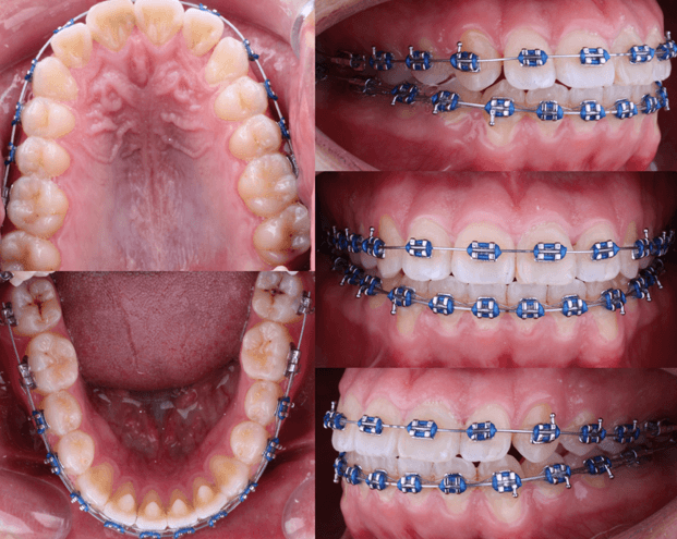 Fig 8. Seguimiento fotografico