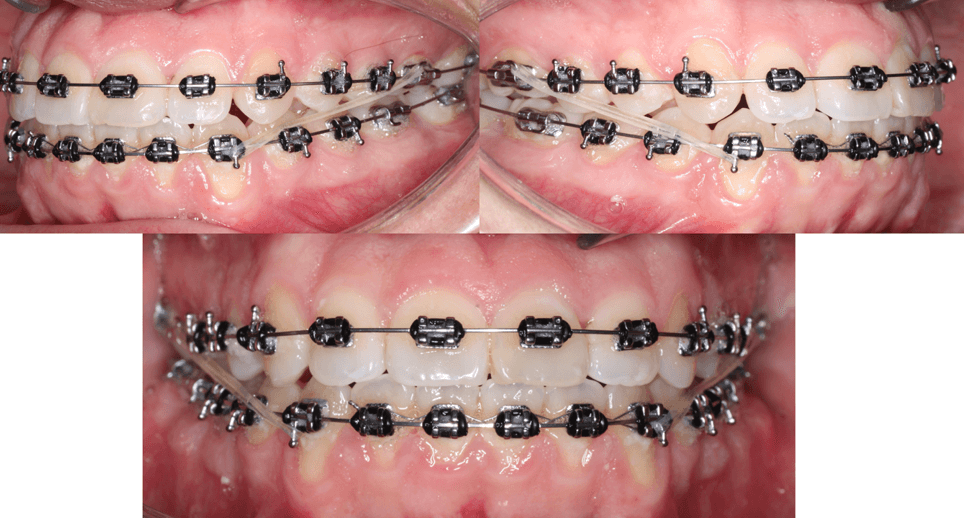 Fig 10.1 Panoramica 9 meses de tratamiento