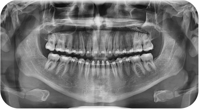 Fig 13. Seguimiento fotografico
