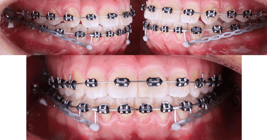 Fig 14. Seguimiento fotografico
