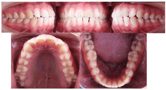 Fig 2. Fotografias intraorales