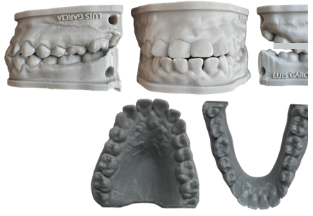 Fig 3. Modelos intraorales