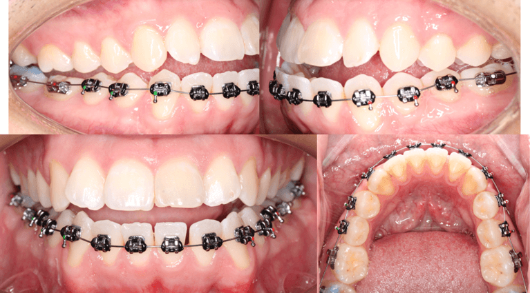 Fig 5. Seguimiento fotografico