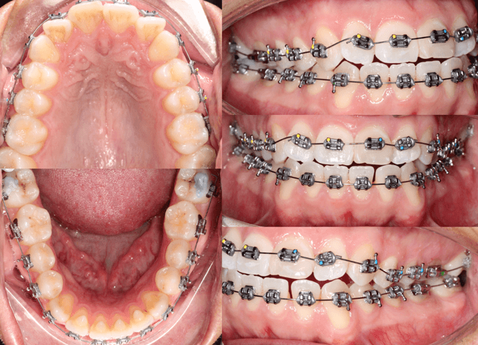 Fig 6. Seguimiento fotografico