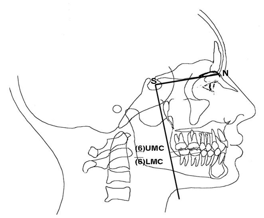 La altura facial anterior está dada por la distancia medida en una perpendicular desde Nasion hasta el plano palatino (AUFH) y en posterior superior, de la silla a plano palatino (PUFH). La altura anterior inferior se mide desde el plano palatino al Mentón (ALFH) y la altura posterior inferior desde el plano palatino a gonion (PLFH). 