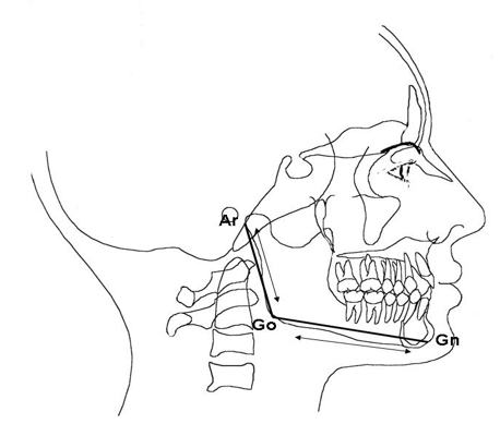 Esto nos permite evaluar el crecimiento de la mandíbula tanto en altura como en su tamaño total El plano mandibular lo medimos por una línea que va desde Mentón a Gonion, esta medición facilita describir los crecimientos o desplazamientos en el cuerpo de la mandíbula
