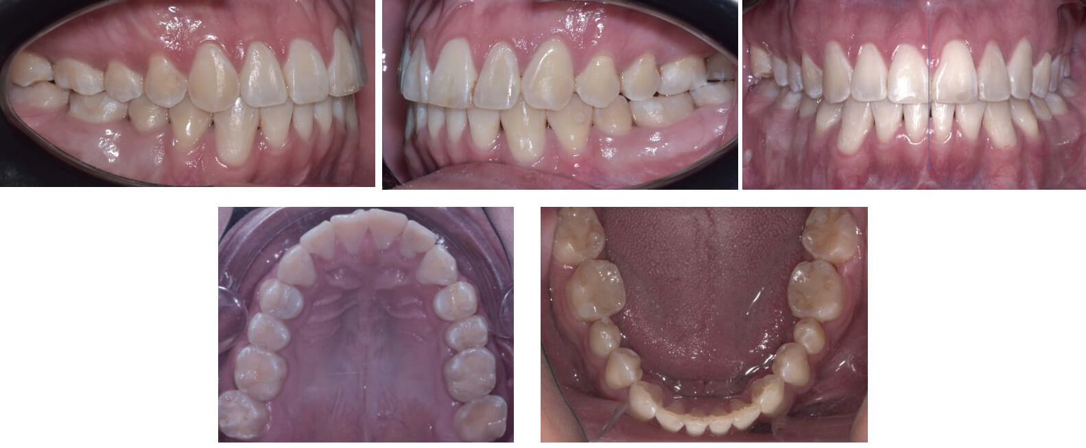 Fig. 9 Intraorales finales