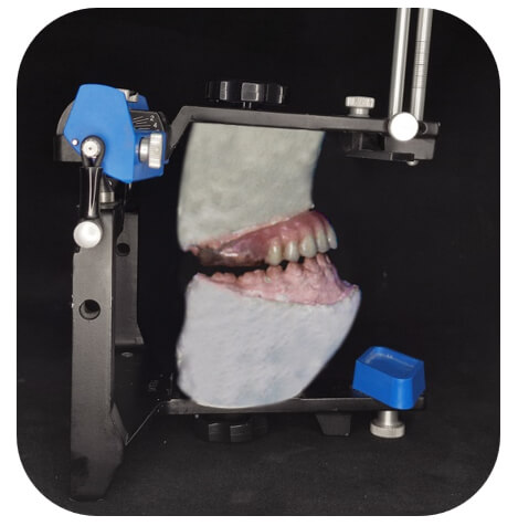 Férula Oclusal con enfilado dentario.Fig (5)