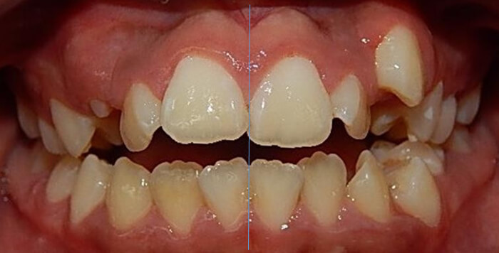 Fig.2 Intraoral de frente