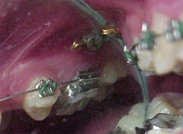 Fig. 9