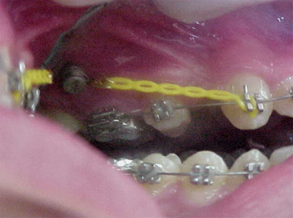 Fig. 10