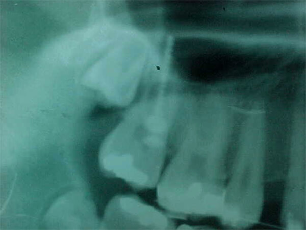 Fig. 11
