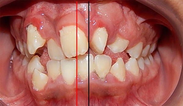 Fig. 9 frente