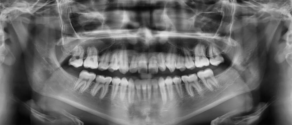 Fig. 6 Radiografía Panorámica