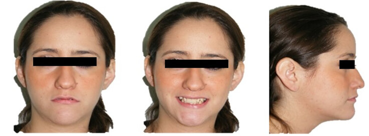 Fig. 1. frente, con sonrisa y perfil