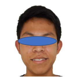 Fig. 2 frente sonrisa