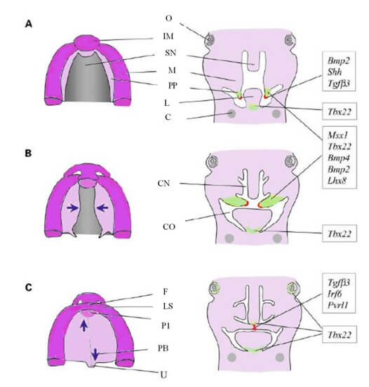 Figura 2. Etapas críticas del desarrollo del labio y el paladar. A: Secciones horizontales y coronales emparejadas de cabezas de ratón en E12.5 (semana humana ≈7). Las prominencias nasales medias se fusionan para formar el segmento intermaxilar (IM) mientras que las partes laterales del labio superior se forman a partir de las prominencias maxilares (PM). Los procesos palatinos (PP) también brotan de las prominencias maxilares (PM) y crecen verticales hacia la lengua (L). B: En el ratón E13.5 (semana humana ≈8), los procesos palatinos sufren remodelación epitelial y se elevan a una posición horizontal por encima de la lengua. Las flechas moradas indican la posición del contacto inicial de los procesos y la fusión. C: Con el ratón E14.5 (semana humana 9-10), el segmento intermaxilar se convierte en el filtrum (F) del labio superior (LS) y el paladar primario (P1). Los PP se han fusionado en ambas direcciones, anterior y posterior (flechas moradas), junto con el tabique nasal. La unión epitelial se rompe y la osificación comienza en el paladar anterior (duro). Los sitios de expresión para algunos de los genes clave que afectan la palatogénesis se indican en las secciones coronales: el sombreado verde corresponde a la expresión de Tbx22; el rojo indica el epitelio del borde medial palatino caracterizado por la expresión de Tgfb3. Los genes como Pvrl1 y p63 se expresan a través del epitelio oral. SN=Septum Nasal; O=Ojo; CM = cartílago de Meckel; CN = cavidad nasal; CO = cavidad oral; PB = paladar blando; U=úvula. (Adaptado de Stanier & Moore 8)
