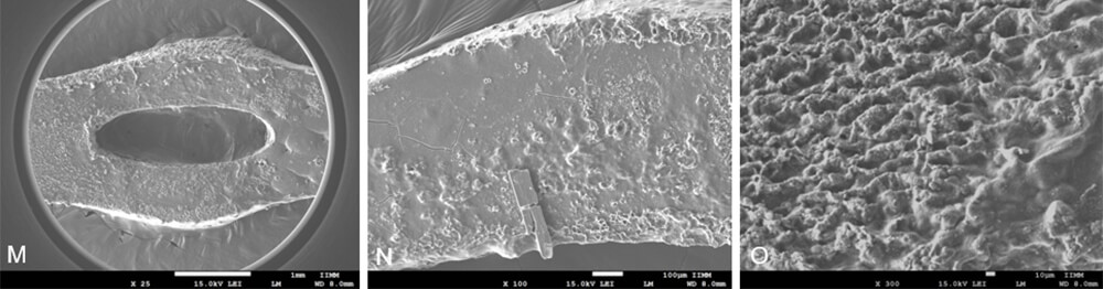 Figura 5. A) Módulo elastomérico marca ORMCO retirado de un paciente con labio y paladar hendido a 1 mes de haberse colocado. B) Zona donde se desprende el módulo de la llave, se logra apreciar que el daño estructural representa una superficie con rugosidad ideal para acumulación de biofilm. C) Área donde hace presión el arco, se observa una deformación del elastómero presentando zonas rugosas que permiten la acumulación bacteriana. D) Módulo elastomérico marca AMERICAN ORTHODONTICS retirado de paciente con labio y paladar hendido a 1 mes de haberse colocado. E) Deformación del elastómero. F) Zonas con rugosidad del elastómero que favorecen la retención de biofilm. G) Cadena elastomérica marca AMERICAN ORTHODONTICS retirado de paciente con labio y paladar hendido a 1 mes de haberse colocado. H) Daño estructural. I) Deformaciones del elastómero vistas a 200x. J) Cadena elastomérica marca ORMCO retirado de paciente con labio y paladar hendido a 1 mes de haberse colocado. K) Zonas con deformación estructural vistas a 100x. L) Grieta en zona de tensión. M) Cadena elastomérica marca ORTHO PREMIUM retirado de paciente con labio y paladar hendido a 1 mes de haberse colocado. N) Pérdida de estructural del elastómero. O) Presencia de rugosidad vista a 100x.