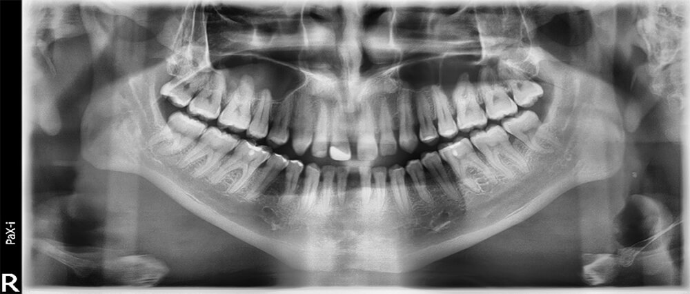 Fig .8 Radiografía panorámica