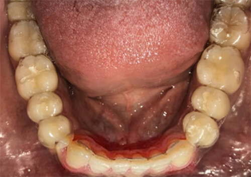 Fig.21 inferior