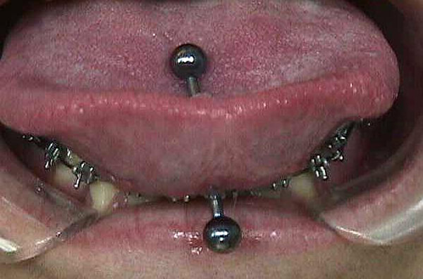 Piercings