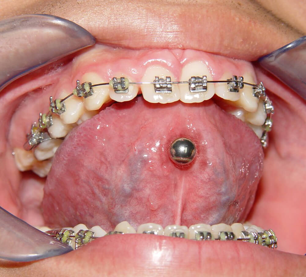 Piercings