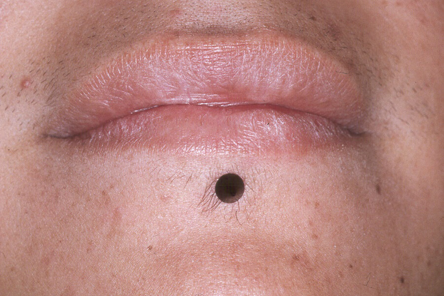 Piercings