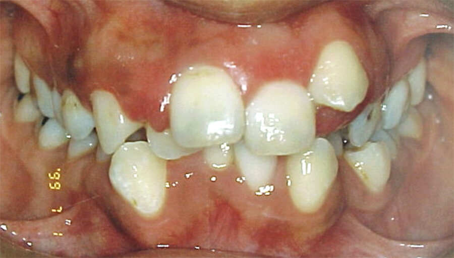 Fig. 2