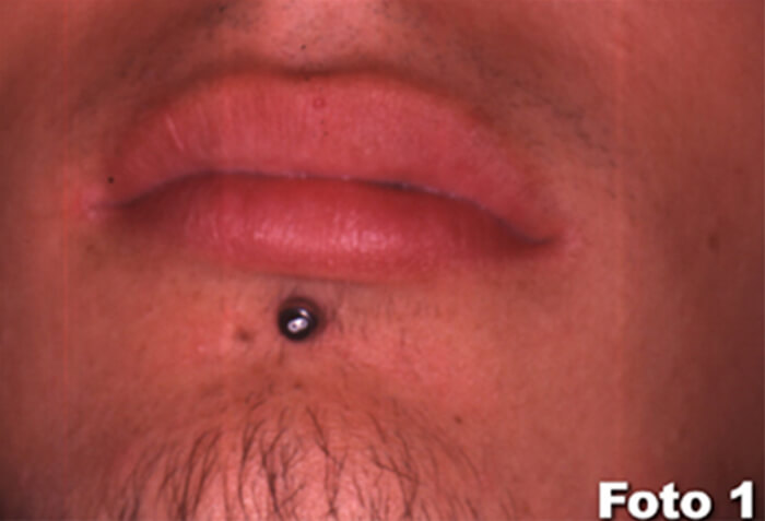 Foto 1