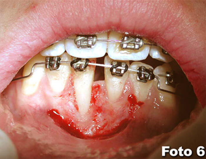 Foto 6