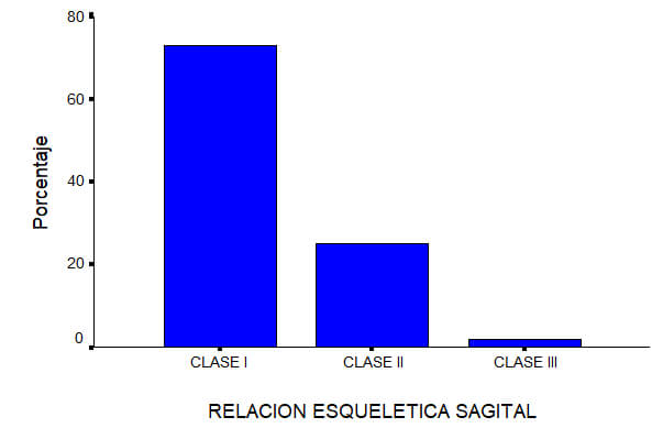 Grafico Nº 5 Relación esqueletal sagital en dentición mixta.