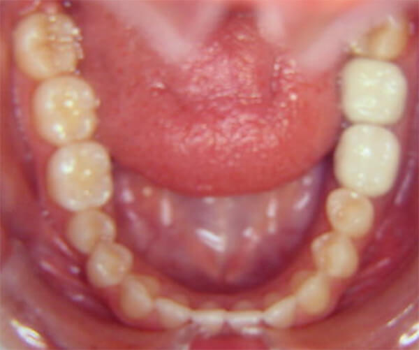 Fig. 8
